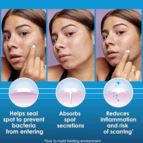 Clearasil Day and Night Acne Spot Patches, Hydrocolloid Technology, Value Pack, 30 Count