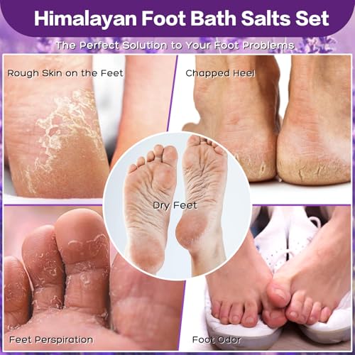 Himalayan Pink Salt Foot Soak Kit - 3 Pack Epsom Salts with Essential Oils