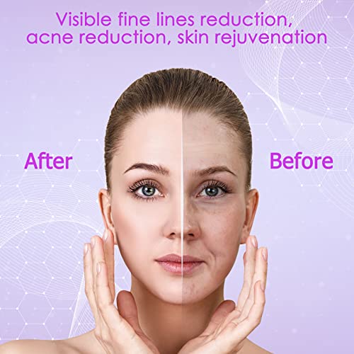 YourMate High Frequency Facial Wand with 4 Neon Tubes