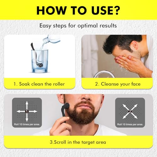 Titanium Derma Roller 540 Needles 0.3mm for Face & Hair