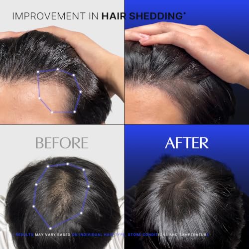 Men's Hair Growth Serum with Brush Applicator | Exosome & Biotin