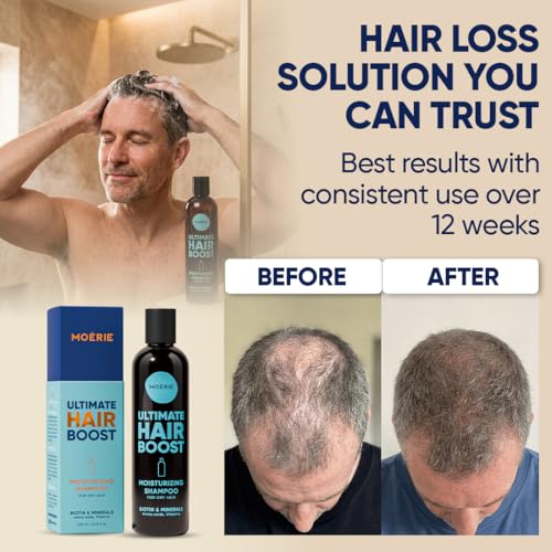 Moerie Hair Growth Shampoo for Men & Women – Biotin & Rosemary, 3-Pack