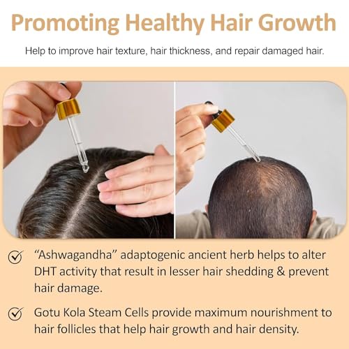 Nirvana Nurture Ultra Restore Hair Growth Serum - Reduce Hair Loss & Promote Fuller Growth