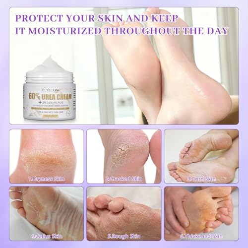60% Urea Cream with 2% Salicylic Acid - Callus Remover Foot Cream (150g)