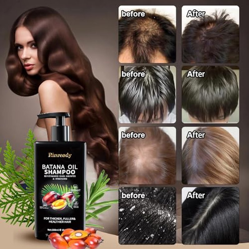Batana Rosemary Biotin Shampoo for Thinning Hair