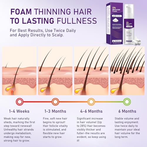 5% Minoxidil Foam for Women - Hair Growth & Thinning Solution