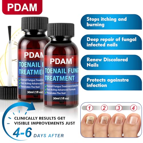 Toenail Care Solution with 25% Undecylenic Acid - 2 Pack
