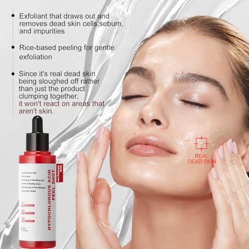 Gentle Exfoliating Serum with Hypochlorous Acid & Rice Extract - Daily Peel Solution for Smooth & Radiant Skin - 80ml