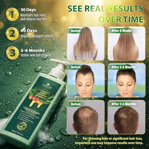 Rosemary & Batana Oil Hair Growth Shampoo for Men & Women