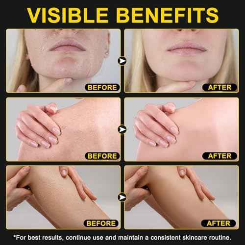 Beef Tallow for skin, Beef Tallow, Hydrating Tallow Balm with Raw Honey and Beeswax, Grass-Fed Beef Tallow & Raw Wild Honey Blend, Body & Face Moisturizer, Natural Formula