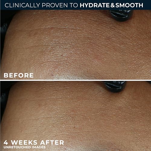 RoC Retinol Correxion Max Hydration Anti-Aging Face Moisturizer