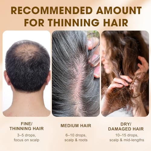 Onion Oil for Hair & Scalp - Nourishing Blend with Coconut & Rosemary, 60ml