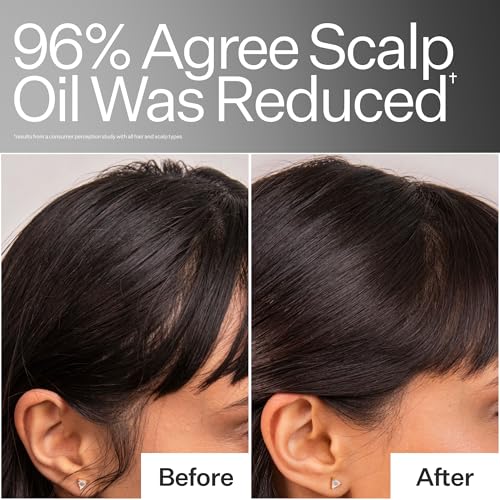 Act+Acre 4% Niacinamide Oily Scalp Serum - 2.2 Fl Oz