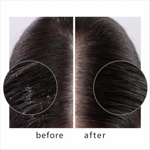 Chihtsai JOY Scalp Refreshing Shampoo 18.1oz Dandruff Control All Hair Types