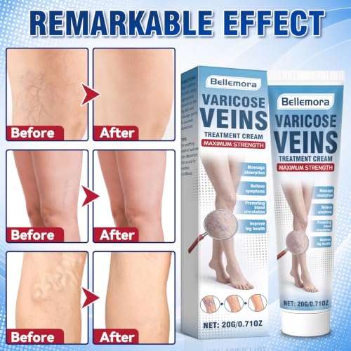 Bellemora Varicose Veins Cream – Relief for Legs & Circulation