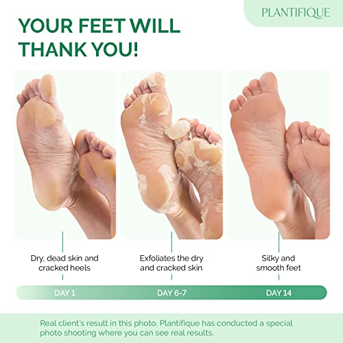 PLANTIFIQUE Foot Peeling Mask 2 Pack | Dermatologist Tested