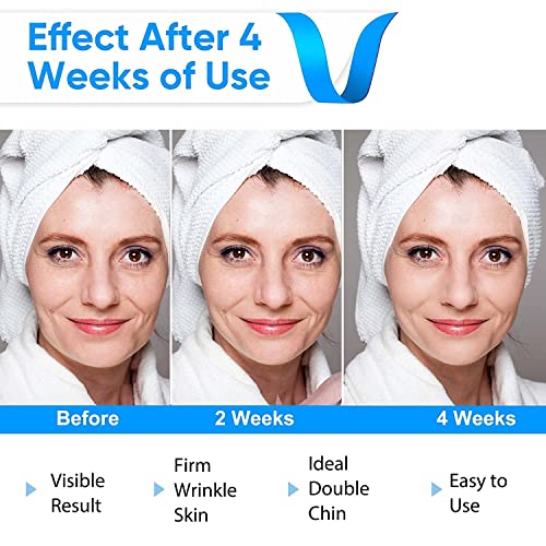 V Line Face Lift Massager with Blue Light - Double Chin Reducer