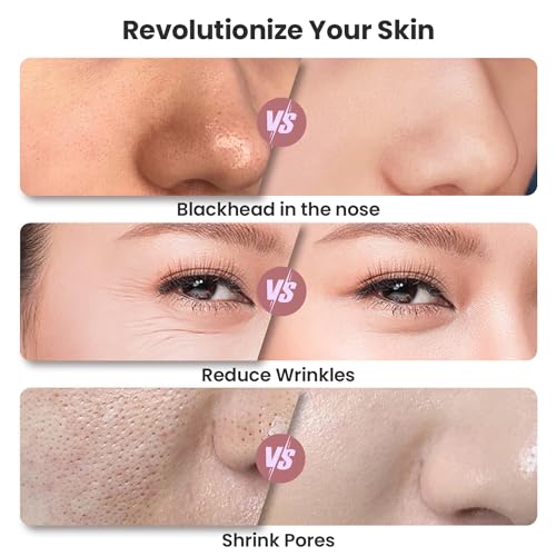 Diamond Microdermabrasion Machine - Blackhead Remover & Pore Vacuum