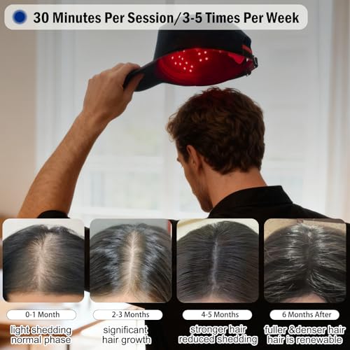 CWTUL Laser Hair Growth Cap with Red & Blue Light Therapy for Hair Regrowth