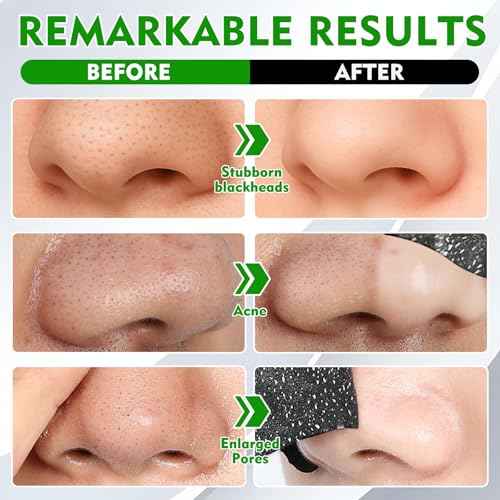 Blackhead Remover Strip, Nose Strips Blackhead Remover, Deep Cleansing & Oil Control, Ideal for All Skin Types (10 Pack)