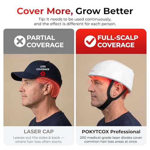 FDA Cleared Laser Hair Growth Helmet - 200 Diodes for Men & Women