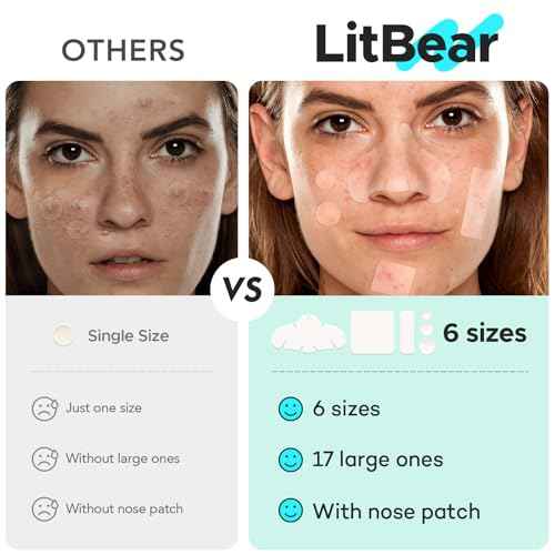 LitBear Large Pimple Patches for Face (6 Sizes 401 Counts), Big Hydrocolloid Acne Patches, XL Hydrocolloid Bandages for Body, Cheek, Forehead, Chin, Full Face, Back, Nose