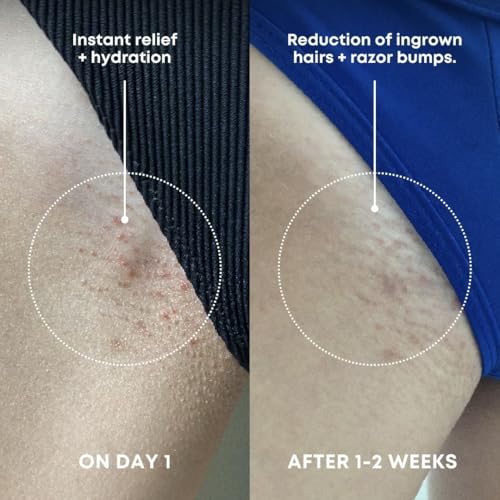 Bushbalm Ingrown Hair Exfoliating Scrub, 236ml