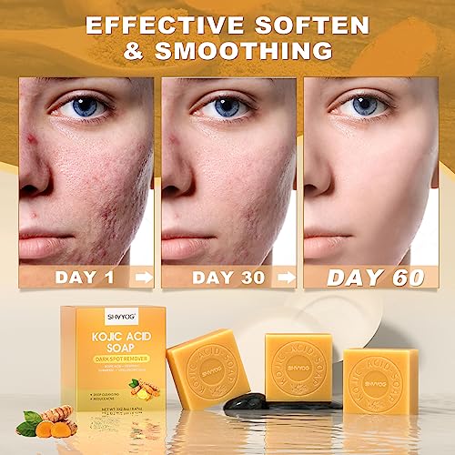 SHVYOG Kojic Acid Soap, Turmeric Soap Bar, Dark Spot Remover with Vitamin C Hyaluronic Acid for Deep Cleansing, Gentle Soap for Face and Body with A Foaming Net, 8.47oz（3 Pack）