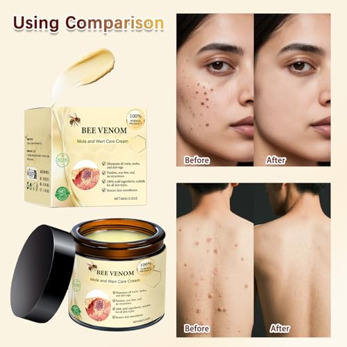 2Pcs Bee Venom Skin Treatment Cream, Bee Venom Comprehensive skincare Cream, 2025 New Professional Bee Venom Gel, Bee Venom Moisturizing Gel for All Body Parts, 2.12OZ / 60g