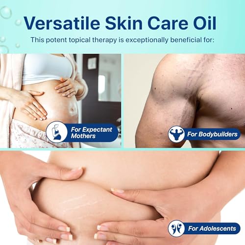 Stretch Mark Oil, Minimizes the Risk and Severity of Stretch Marks, Gentle Belly Oil for Pregnancy, Made of Natural Ingredients, Suitable for Adults and Children, 120mL£¨4.06 Fl Oz£©