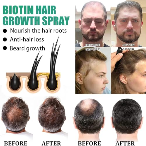 Rosemary Oil & Biotin Hair Growth Spray 60ml