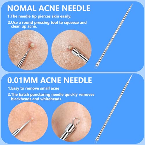 5PCS Blackhead Remover Kit Stainless Steel Comedone Extractors for Acne