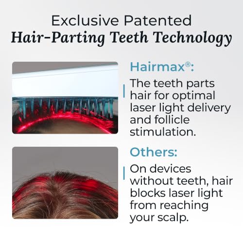 Hairmax Ultima 12 LaserComb - FDA Cleared Hair Regrowth