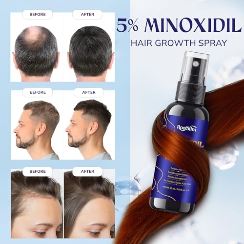 RootStim Extra Strength 5% Minoxidil Hair Growth Treatment 3-Pack