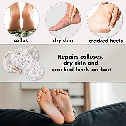 Natural Lava Pumice Stone for Feet - Callus Remover, Pack of 2