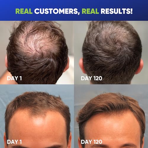Svvimer Biotin Hair Thickening Shampoo for Men, 13.5 Fl Oz