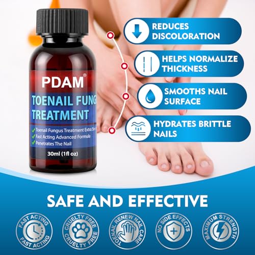 Toenail Fungus Treatment - 25% Undecylenic Acid Maximum Strength