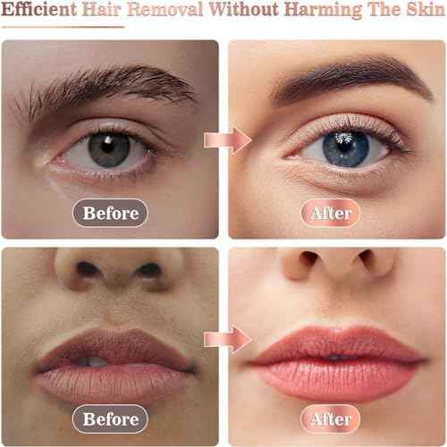 Facial Hair Removal for Women, Portable Lady Shaver, Rechargeable Painless Hair Remover for Face, Upper Lips, Chin, Peach Fuzz-Model A
