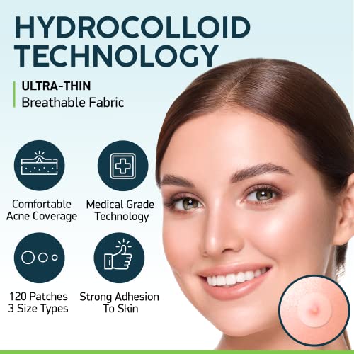 Nuvadermis Acne Pimple Patches - 120 Count Hydrocolloid Stickers