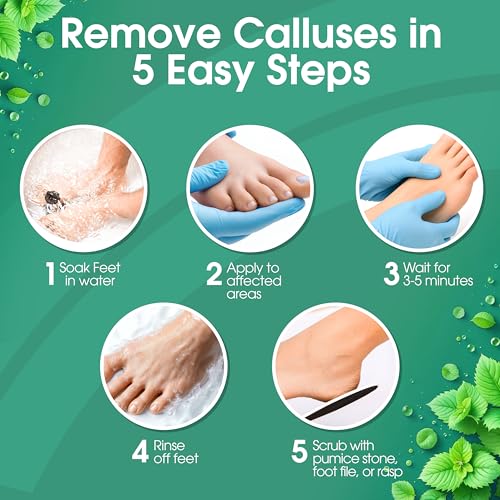 Extra-Strength Callus Remover Gel for Feet - 8oz Cool Mint