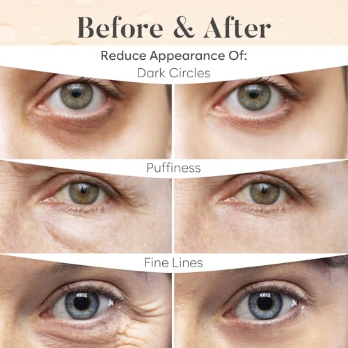 Caffeine Under Eye Patches (30 Pairs) - Dark Circles & Puffiness Care - Hydrating Caffeine Eye Mask