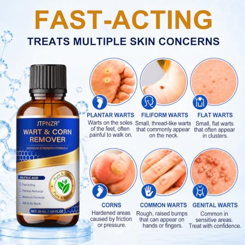 20% Salicylic Acid Skin Tag & Wart Remover - 30ml Kit