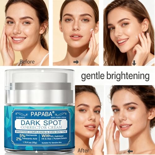 Tranexamic Acid Serum Dark Spot Corrector Cream for Face & Body Women Men - Niacinamide + Vitamin C - Brightening Treatment for Age Spots, Sun Spots Gentle for Sensitive Skin