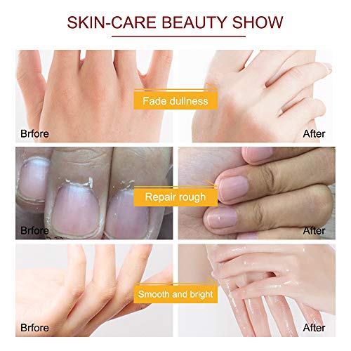 Honey & Milk Exfoliating Hand Peeling Mask Gloves for Dry Skin - 5 Pack