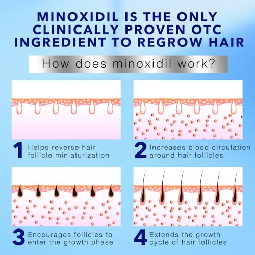 Sefralls 5% Minoxidil Foam for Men's Hair Regrowth - 3-Month Supply