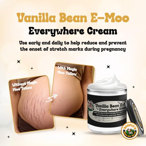 Magic Moo Beef Tallow Vanilla Bean E-Moo Moisturizing Everywhere Suet Tallow Cream with Organic Emu Oil. For Acne, Stretch Marks, Eczema, Hydration, Dry Skin & More! 8oz