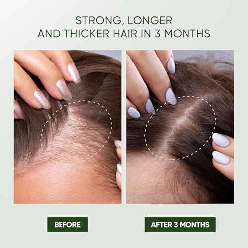 Svvimer Rosemary Hair Growth Shampoo - Thickening Shampoo with Biotin Tea Tree Oil Mint for Hair Loss and Thinning Hair - for Women and Men 11.8 Fl Oz (Pack of 1)