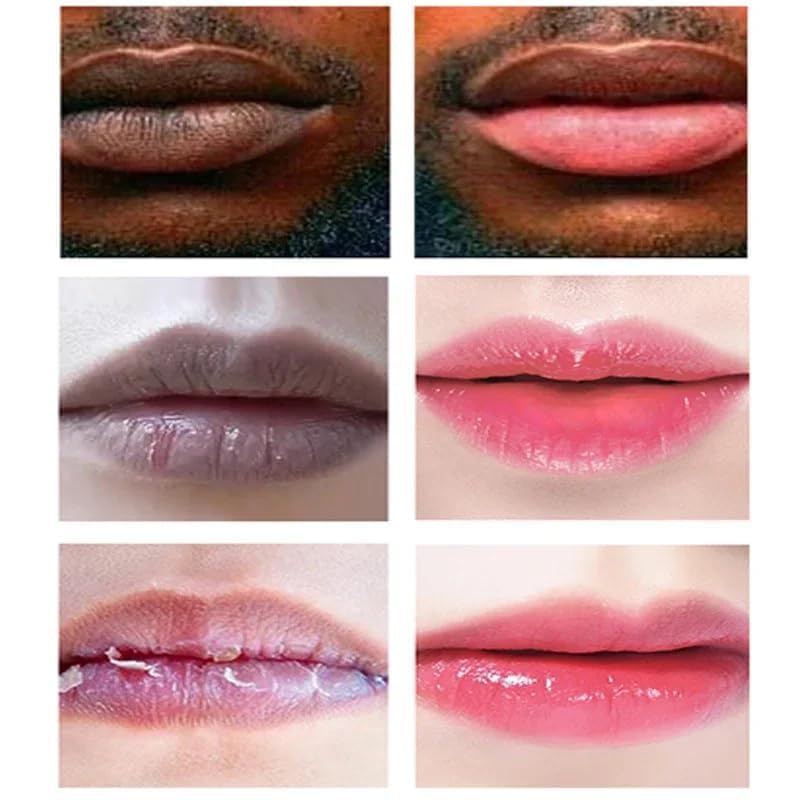 Dark Lip Lightening Balm – Moisturizing & Hydrating for Men Women