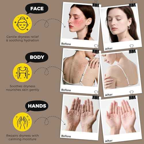 4.2 OZ Beef Tallow for Skin Face, Grass Fed Beef Tallow with Honey Bee Venom Cream Natural Tallow and Honey Balm, Deep Hydration Tallow Face Moisturizer for Dry, Sensitive & All Skin Types