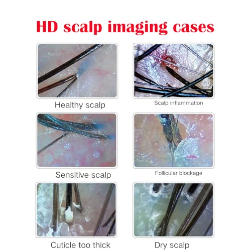 Professional Scalp Analysis Camera with 11-Inch HD Screen for Salons – NETTITO